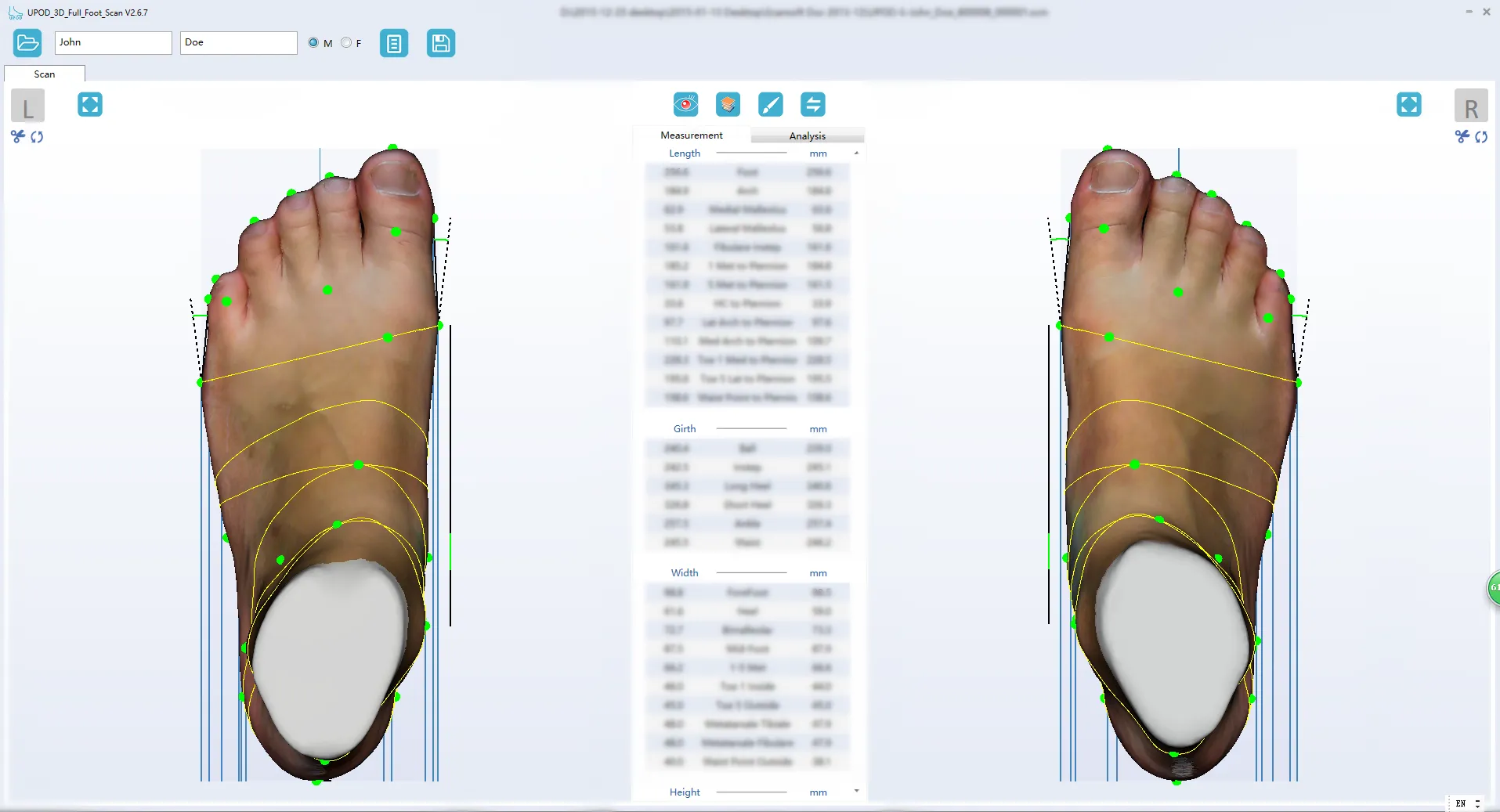 Ортопедический 3D сканер ScanPod3D UPOD-S