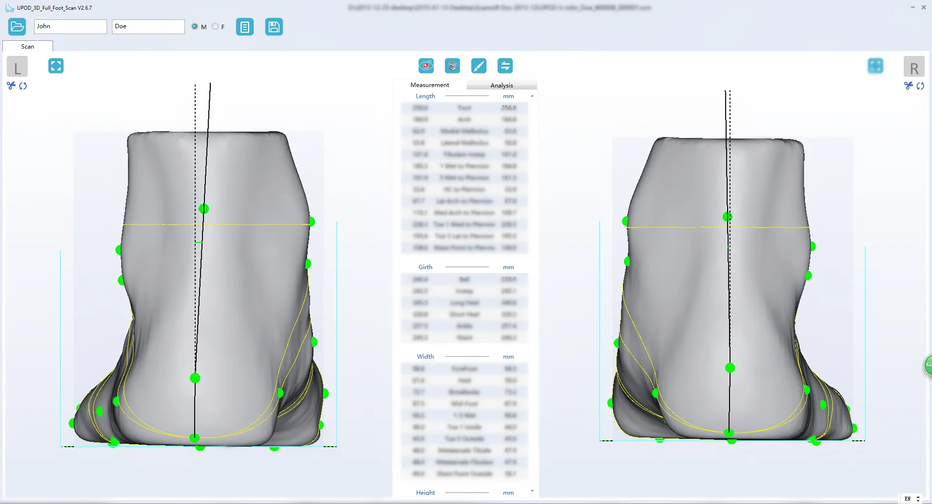 Ортопедический 3D сканер ScanPod3D UPOD-S