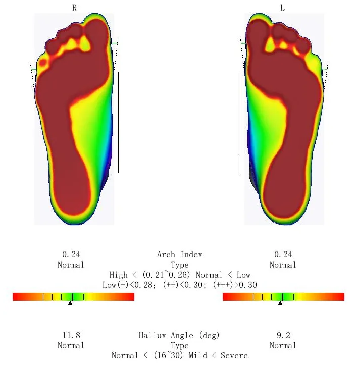 Ортопедический 3D сканер ScanPod3D UPOD-S