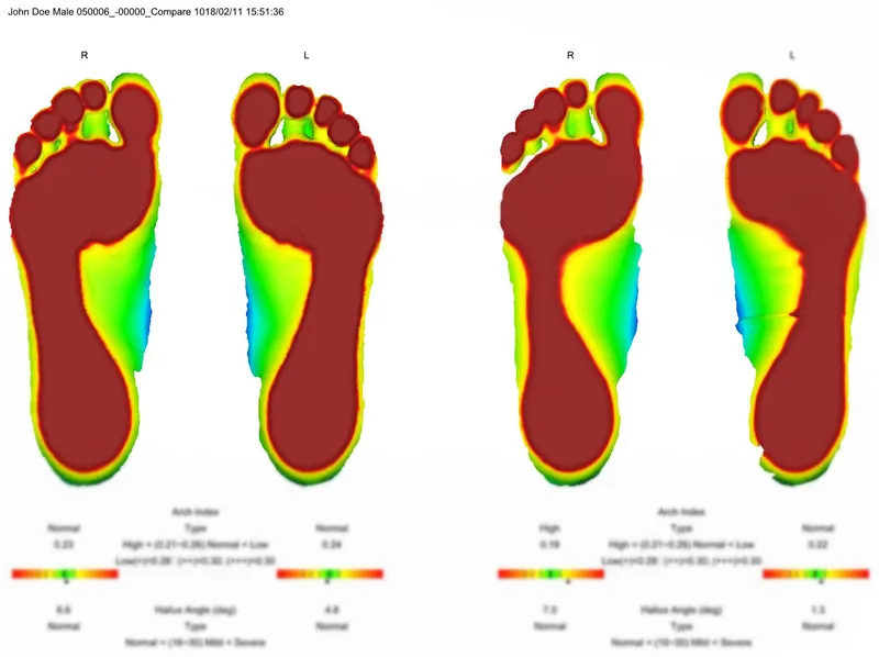 Ортопедический 3D сканер ScanPod3D USOL
