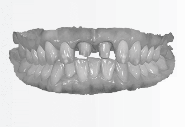 3D сканер 3Shape TRIOS 3 Mono Pod