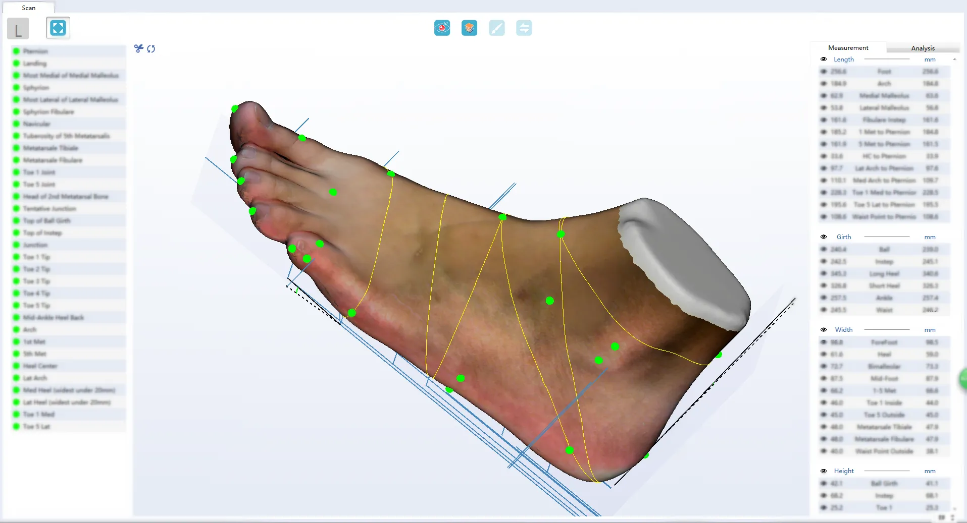 Ортопедический 3D сканер ScanPod3D UPOD-S