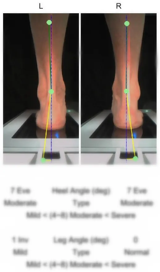 Ортопедический 3D сканер ScanPod3D USOL