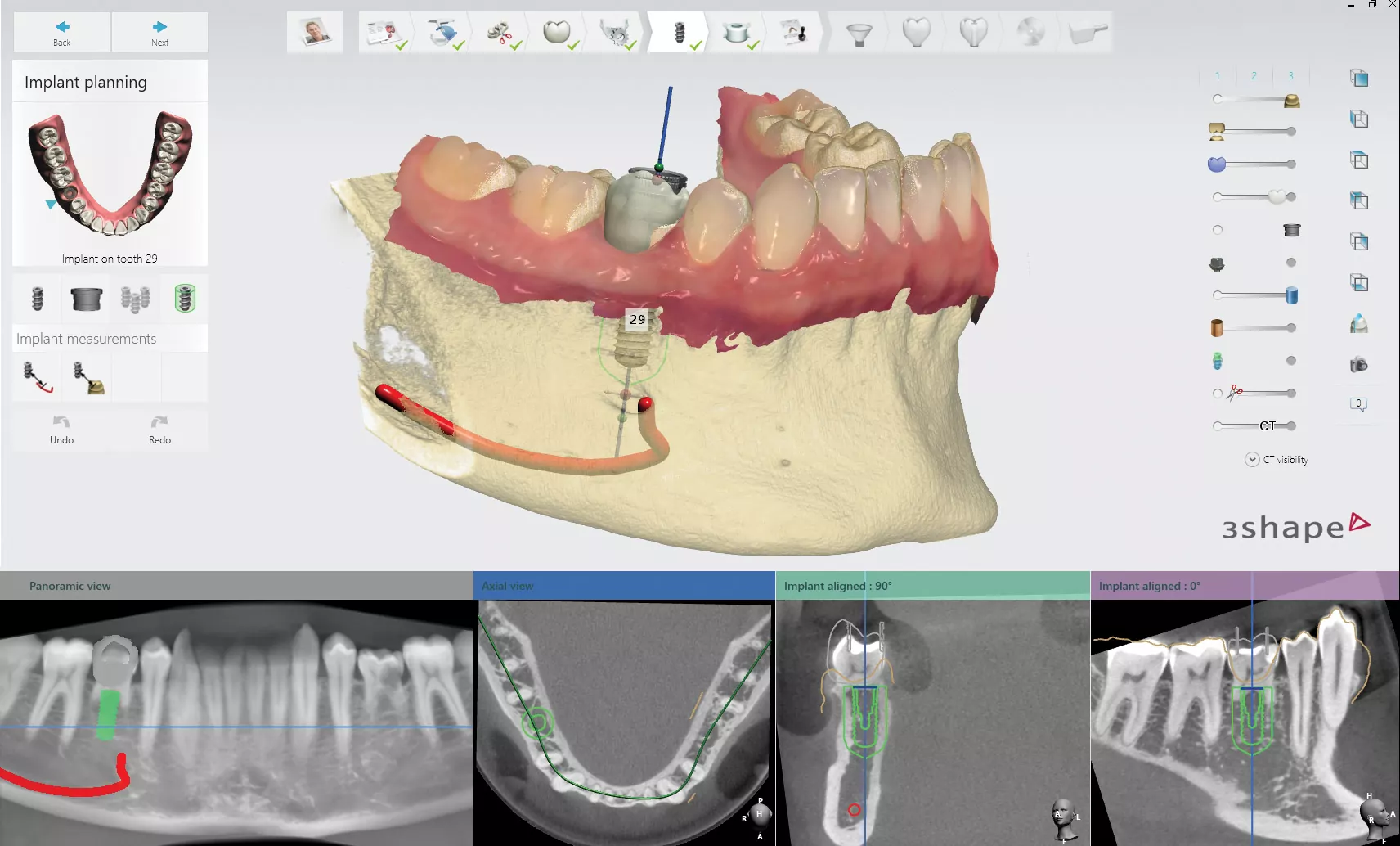 3D сканер 3Shape TRIOS 3 Move+