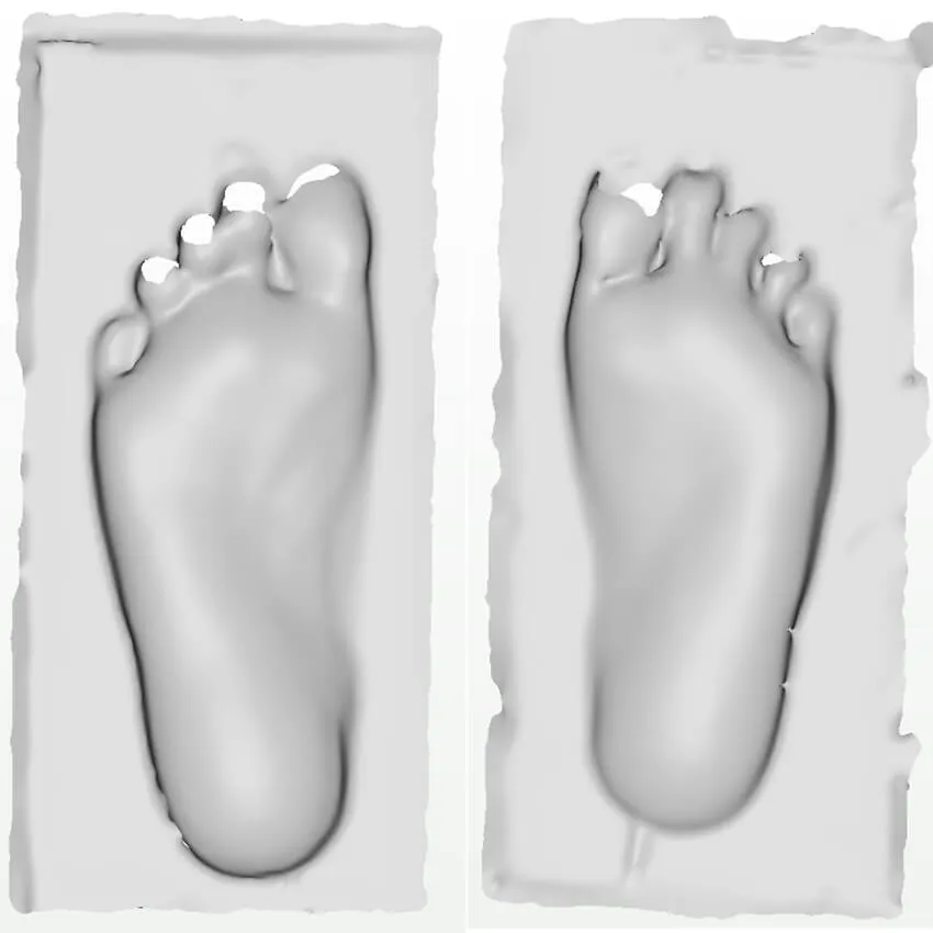 Ортопедический 3D сканер ScanPod3D XSOL-X2 Floor