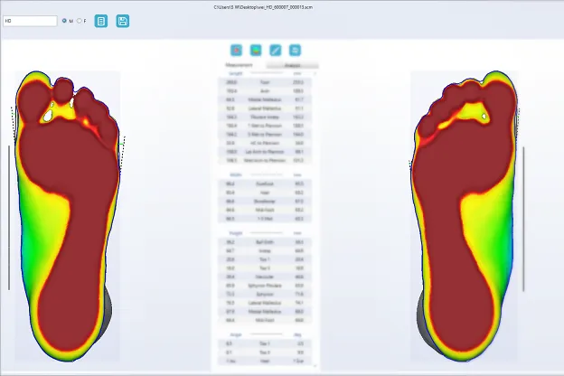 Ортопедический 3D сканер ScanPod3D UPOD-HD