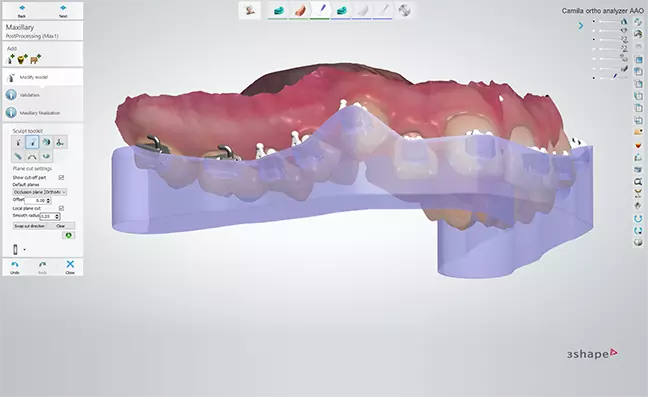 3D сканер 3Shape TRIOS 3 Basic Cart