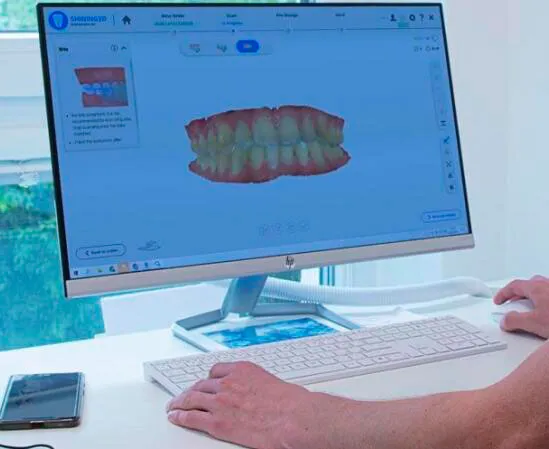 Интраоральный 3D-сканер Shining 3D Aoralscan 3