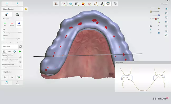 3D сканер 3Shape TRIOS 3 Cart