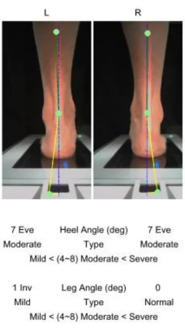 Ортопедический 3D сканер ScanPod3D USOL-X