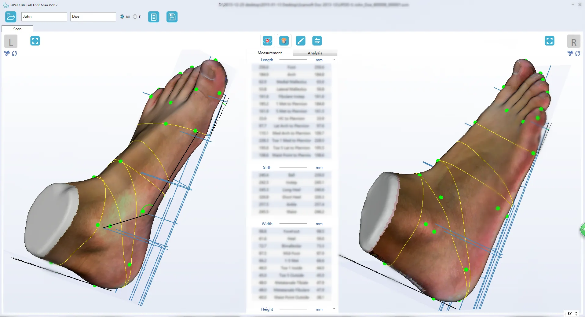 Ортопедический 3D сканер ScanPod3D UPOD-S